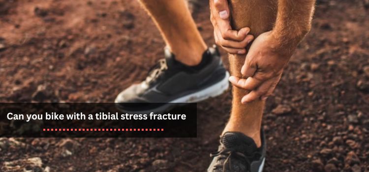 Pedaling Through Pain A Guide to Biking with a Tibial Stress Fracture